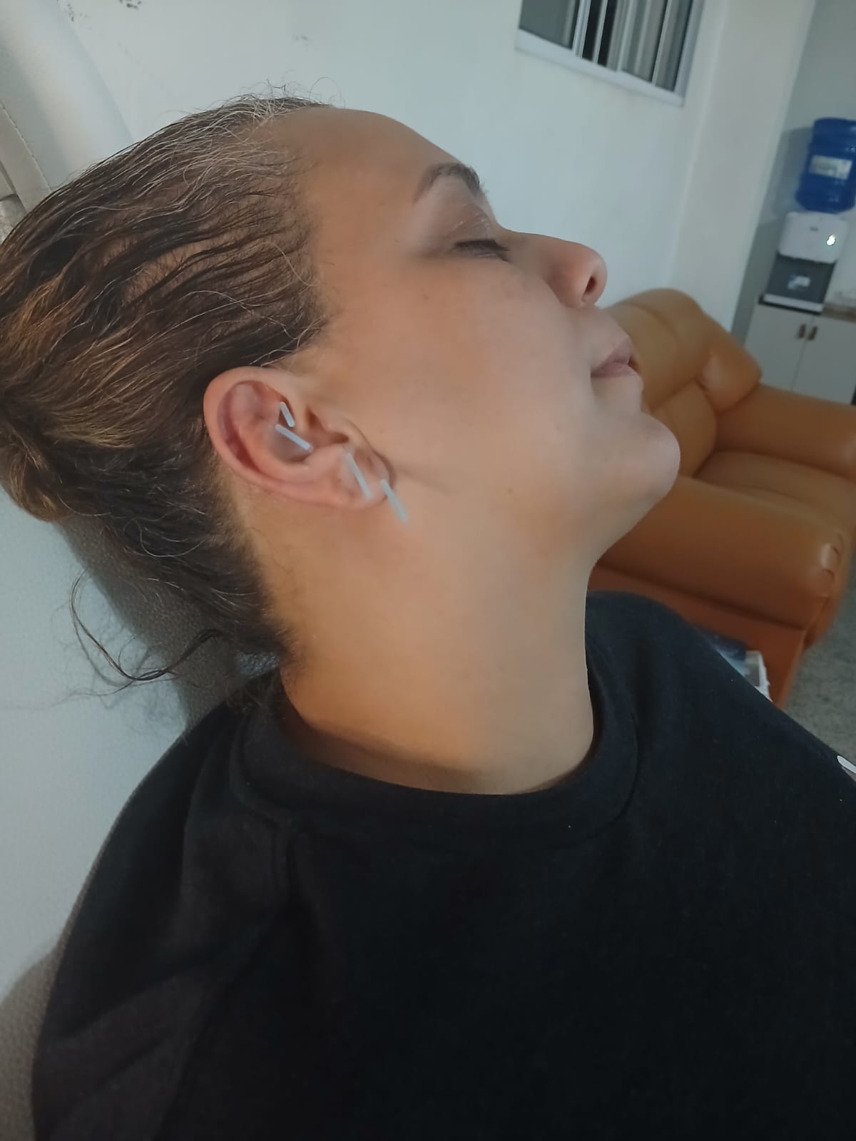 Detalhe da orelha da paciente com aplicação sem agulha